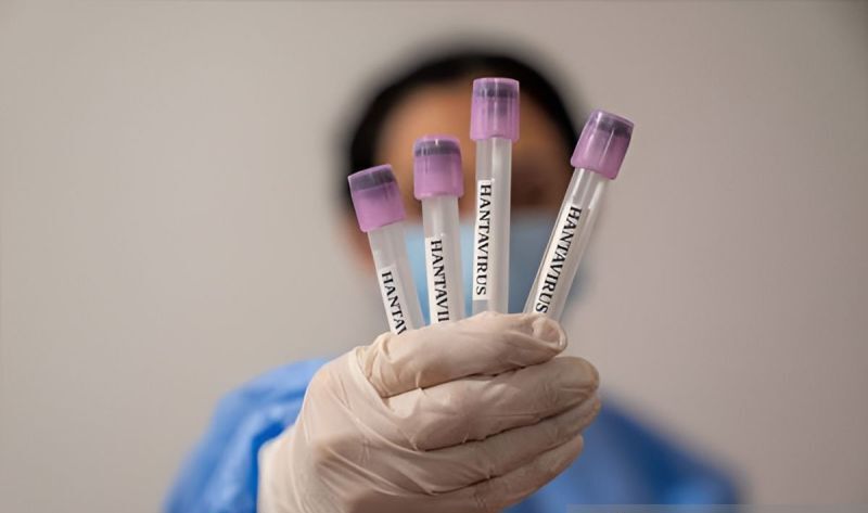 Uji Lab Warga Kulon Progo Suspek Hantavirus Akhirnya Keluar, Ini Hasilnya